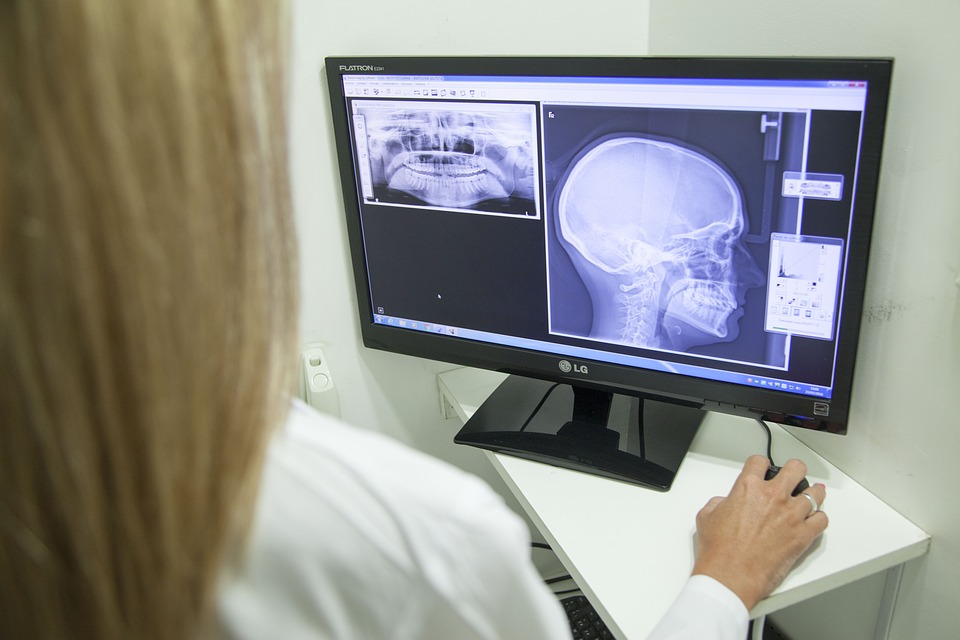 Radiografie digitali